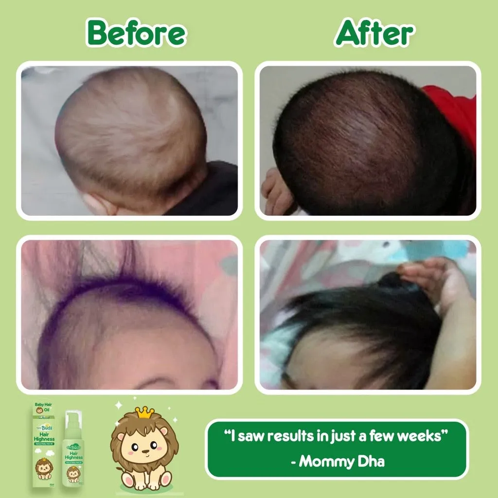 Tiny Buds Hair Highness Natural Baby Hair Oil 50ml
